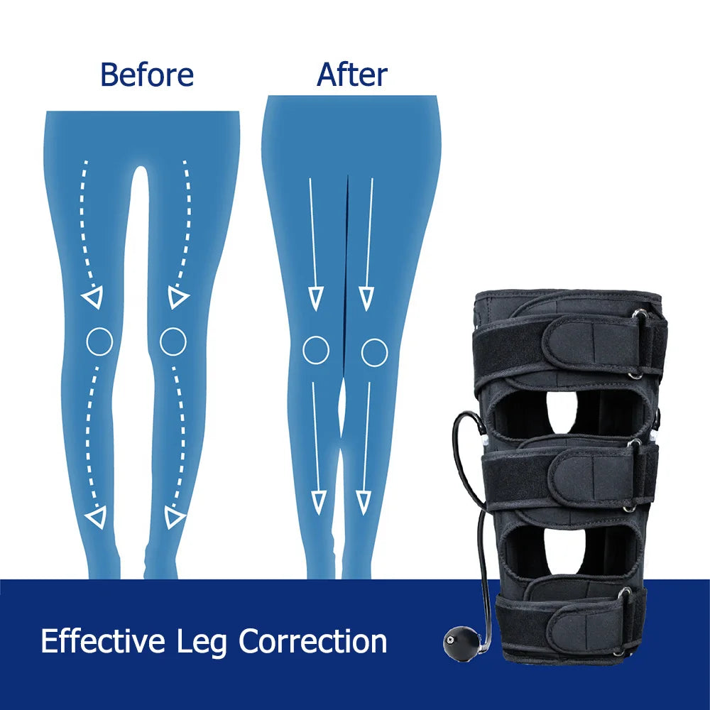 Pressure O/X Type Leg Posture Correction Strap Bent Leg Knee Valgus Straight Beauty Inflatable Leg Strap Adult Children Support