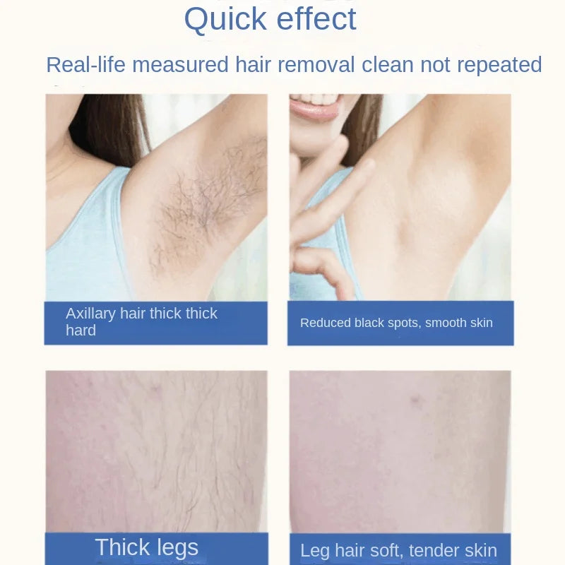 Laser Hair Removal Handset - Pain-Free Hair Remover for Women & Men